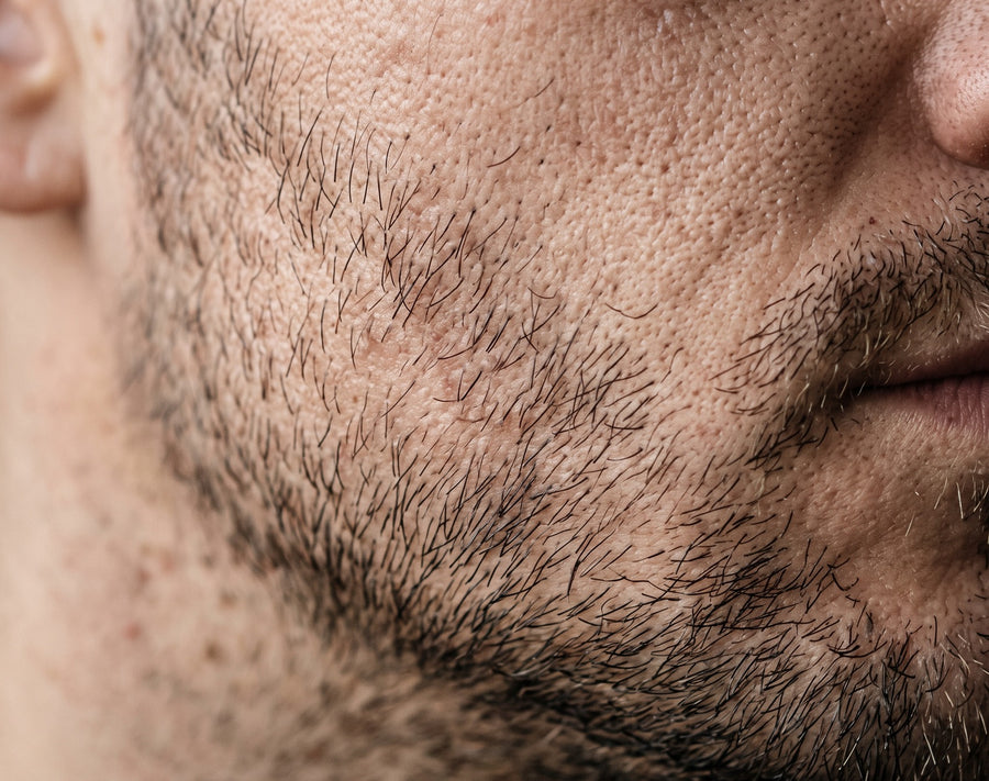 Week 2: less tight, less dry, especially after shaving